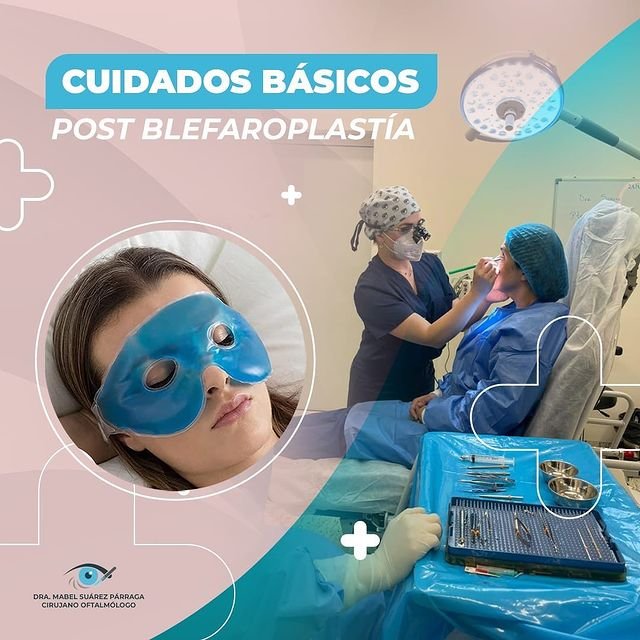 CUIDADOS BÁSICOS DESPUÉS DE LA BLEFAROPLASTÍA